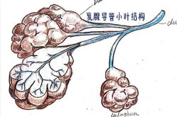 堵奶难题如何破？揉不开吸不出有妙招吗？