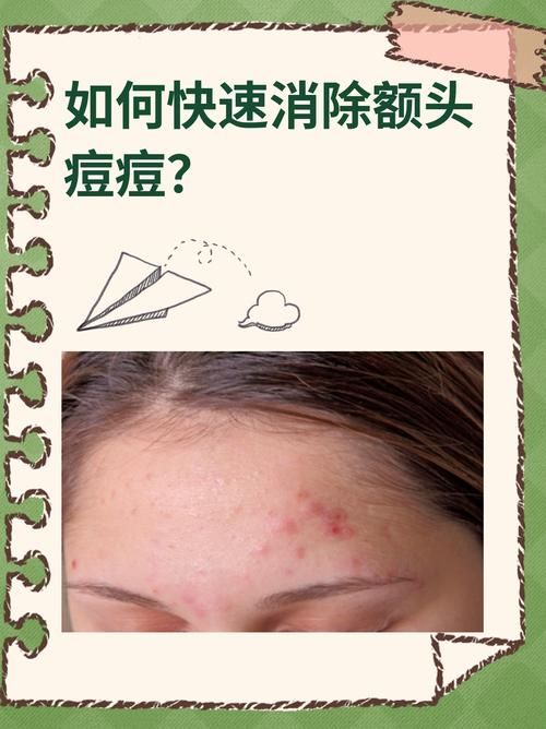 痘痘去除有哪些有效方法？告别痘痘困扰